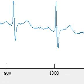 The ECG waveform in normal state | Download Scientific Diagram