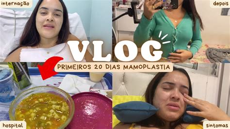 Di Rio Da Mamoplastia Redutora Vlog Dia Da Cirurgia P S Operat Rio