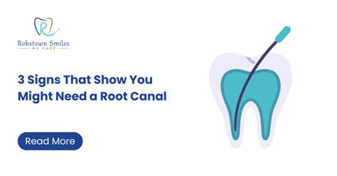 Signs That Show You Might Need A Root Canal Robstown Smiles