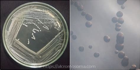 Laporan Praktikum Bakteriologi Karakterisasi Bakteri Escherichia Coli Works