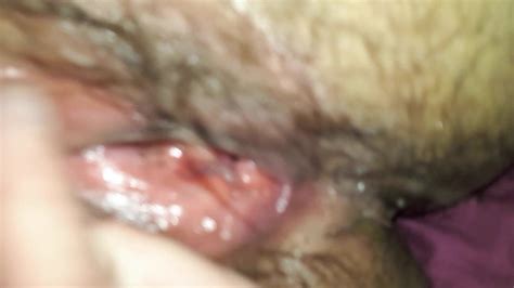 Eating Hairy Ass And Hairy Pussy French Cunnilingus Porn XHamster