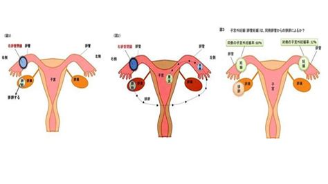 卵子の卵管への取り込み よくあるご質問徐クリニック