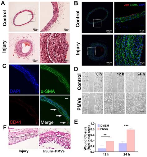 Increased Vsmc Migration After Intimal Injury In Vivo And Pmv Treatment