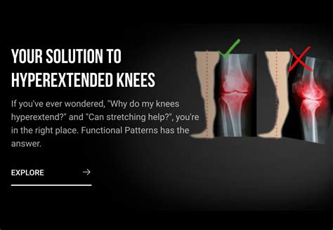 Hyperextended Knees We Have A Fix Functional Patterns