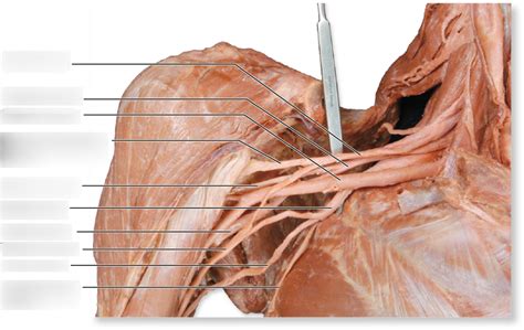 Diagram Of Brachial Plexus Quizlet