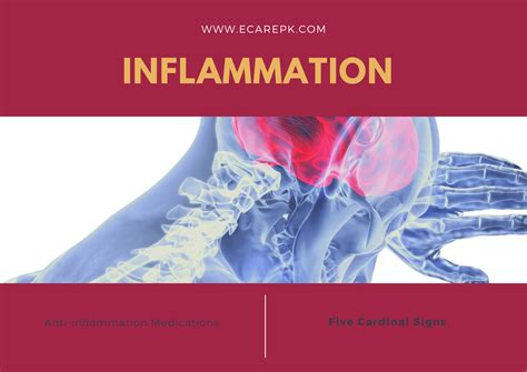 Inflammation The Five Cardinal Signs Of Acute Inflammation And Anti