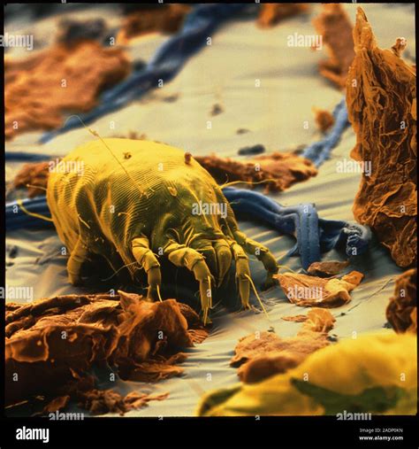 Dust Mite Coloured Scanning Electron Micrograph Sem Of A Single Dust