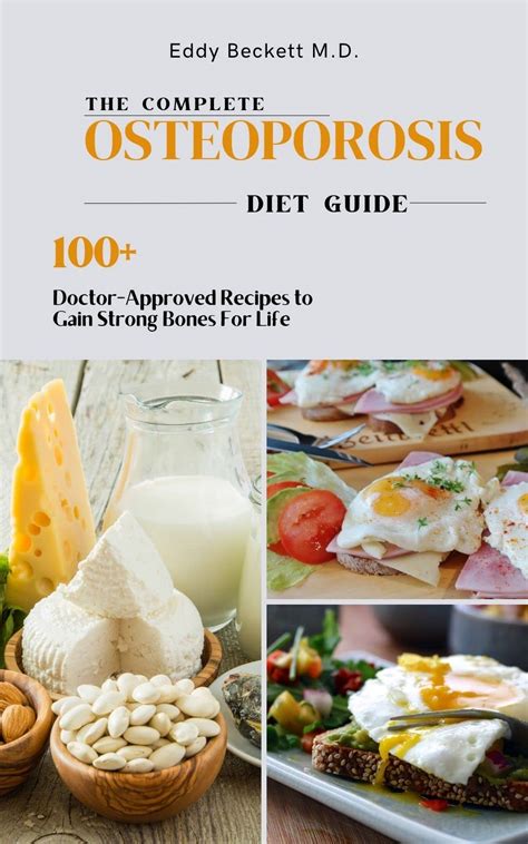 The Complete Osteoporosis Diet Guide: The Step-By-Step Guide To Prevent ...