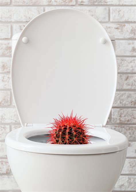 Perianal Abscesses vs Haemorrhoids: Key Differences - Prime Magazine