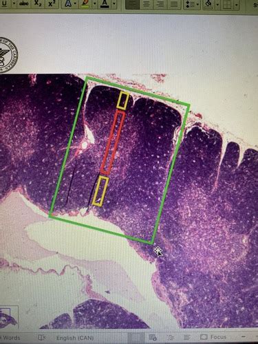 W1 Histo Thymus Flashcards Quizlet