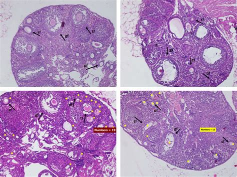 Light Photomicrographs Of Mouse Ovaries With H E Staining A