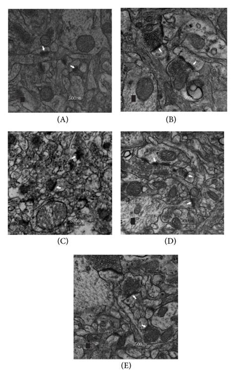 Ultrastructural changes of the hippocampus CA1 subregion in control ... 
