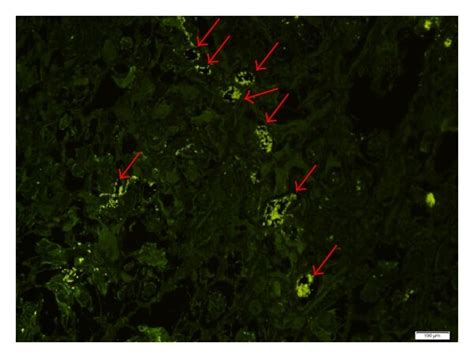 Cd Immunofluorescence Histochemical Staining Of Specimens Weeks