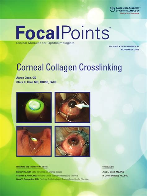 Corneal Collagen Crosslinking Pdf Pdf Cornea Vision