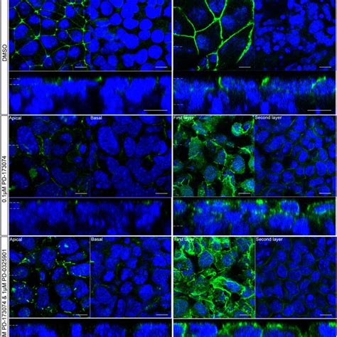 Inhibition Of The Fgfr With PD 173074 Or The Fgfr And Mek Disrupted The