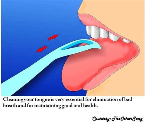 Cleaning Your Tongue Is Very Essential For Elimination Of Bad Breath