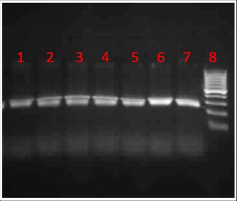 Genotyping Of Exon 7 Polymorphism Rs1801725 In CASR Gene This Gel