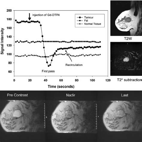 Typical T 1 Weighted Dynamic Contrast Enhanced Dce Mri Study Same