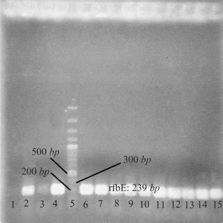 Agarose Gel Electrophoresis Of PCR Product Of E Coli O157 H7 In Order