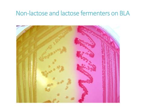 Enterobacter Campylobacter Anaerobes Flashcards Quizlet