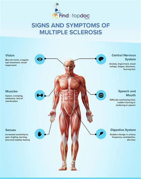 Signs and Symtoms of Multiple Sclerosis Photograph by Finda TopDoc