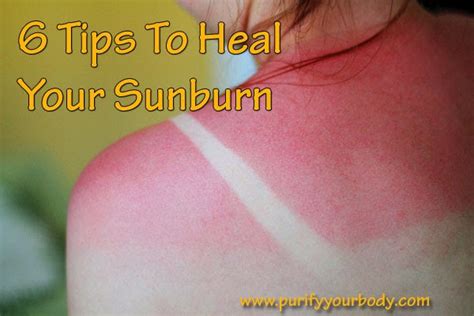 Purify Your Body Detox Foot Pads How To Get Relief From A Bad Sunburn