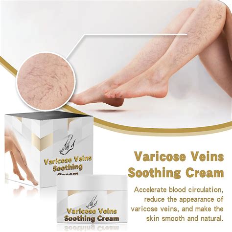 Varicose Veins Treatment Cream Varicose Vein Soothing Leg Cream Relief Phlebitis Legs Spider