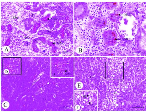 Light Photomicrograph Of Histopathological Lesions In The Kidney A B