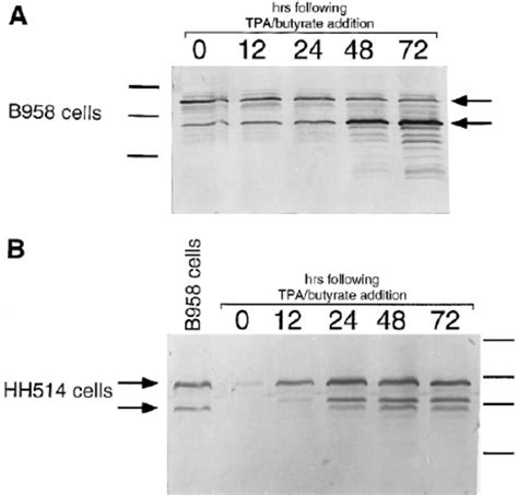 The Lytic Lmp Protein Is Detectable In Bjab Cells Infected With Hh