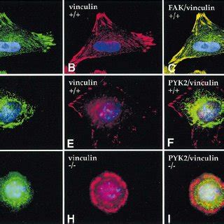 Stimulation of FAK – cell migration toward FN. ( A ) FAK – cells ...