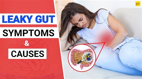 What Is Leaky Gut Symptoms And Causes Guthealth Credihealth YouTube