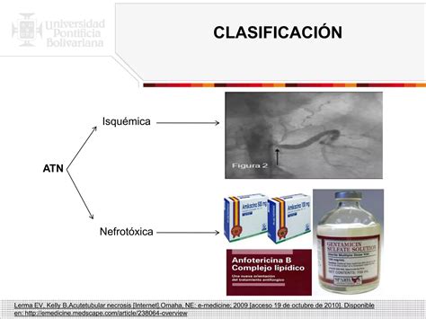 Necrosis Tubular Aguda PPT