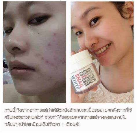 Ke Xin Coey's Crazy World: [Review] Snail White Cream