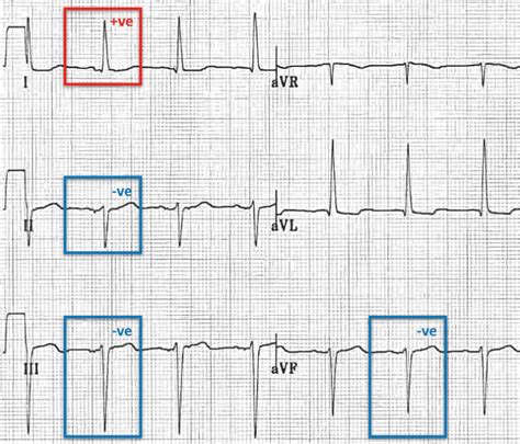 Pin on cardiology