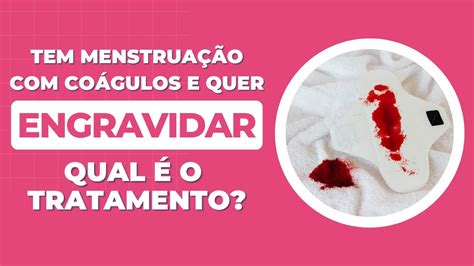 Tem menstruação coágulos e quer engravidar saiba qual o tratamento