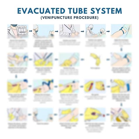 SOLUTION: Flowchart of venipuncture procedure using evacuated tube ...