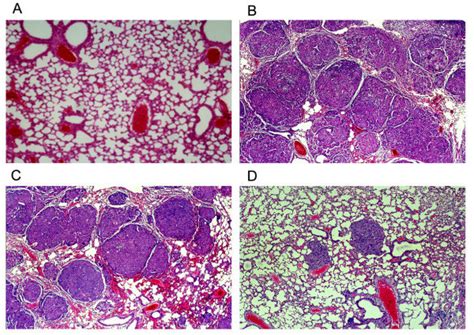 Histological Observation Of The Lung In Four Groups A D A The