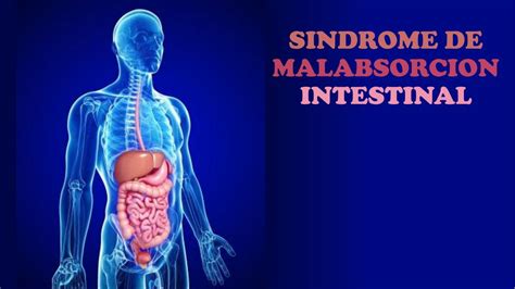 S Ndrome De Malabsorci N Intestinal Amaury Abreu Udocz