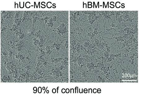 Figure S Fibroblastic Morphology Of Hbm Mscs And Huc Mscs Picture Of