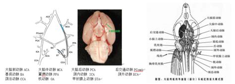 Cerebral Artery Ischemia Reperfusion