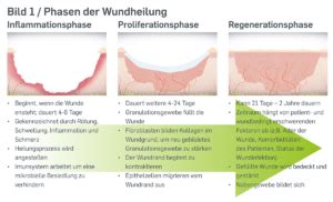 Wundheilung und stagnierende Wunden Ein kurzer Überblick