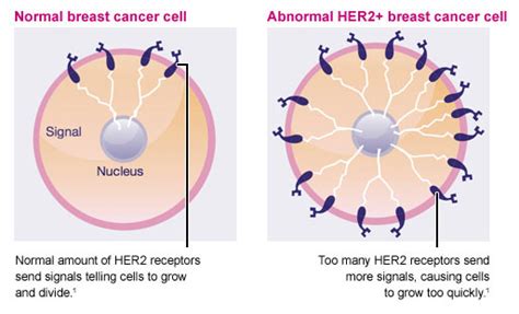 HER2 and Herceptin