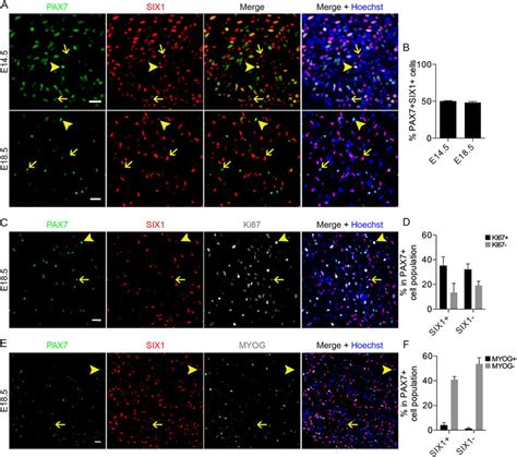 Six1 Is Expressed In The Pax7 Cell Population During Fetal Myogenesis