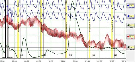 Polygraph Test Lie Detection Services Johannesburg Gauteng