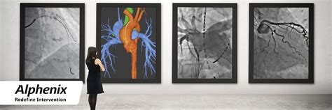 Interventional Cardiology_banner - Canon Medical Systems Italy