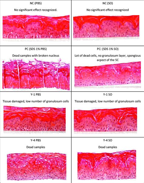 Hes Histology Of Skinethictm Rhe Model Hemalun Eosine Saffron Hes