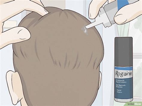 How to Regrow Hair: Can Natural Remedies Help?