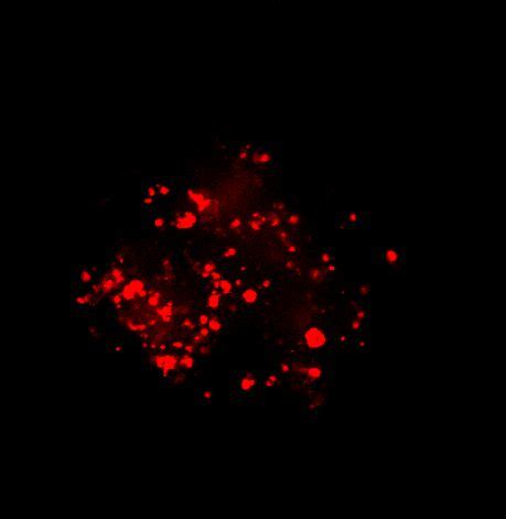 Advances In Cancer Research Imaging Of 3D Tumor Spheroids