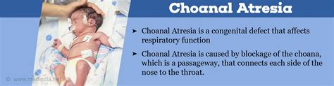 Choanal Atresia Causes Symptoms Diagnosis Treatment And Prevention