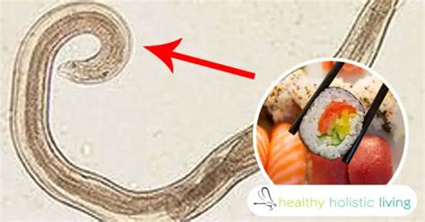 Signs You Have A Worm In Your Brain From Sushi - Healthy Holistic LIving